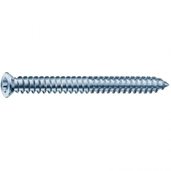 Spax RA Frame Anchor Countersunk Screws - 7.5mm x 100mm - Pack of 100
