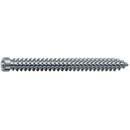 Spax RA Frame Anchor Countersunk Screws - 7.5mm x 150mm - Pack of 100